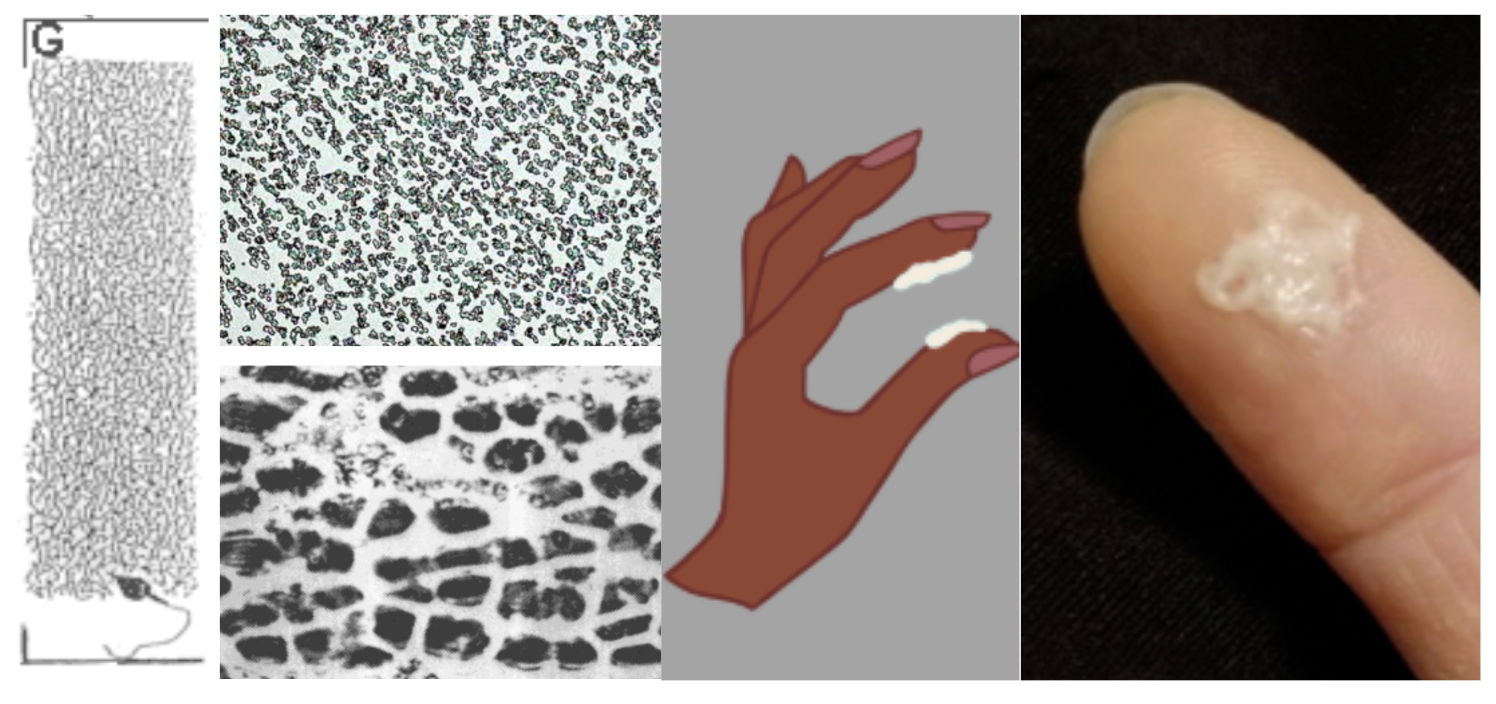 G-type cervical mucus