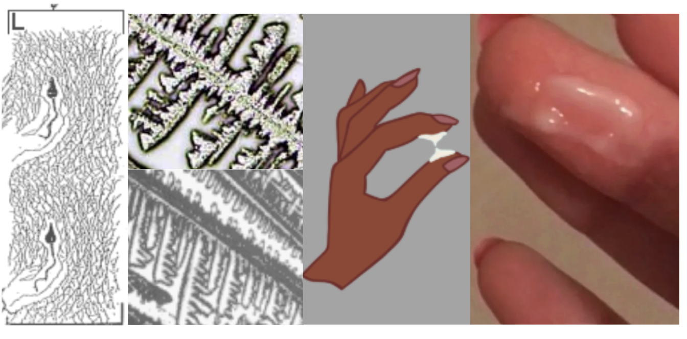 L-type Cervical Mucus