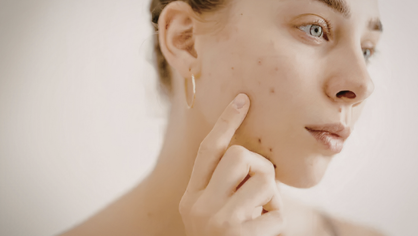 Woman Tracking Skin as Secondary Signs